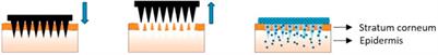 Microneedle-Mediated Transdermal Delivery of Drug-Carrying Nanoparticles